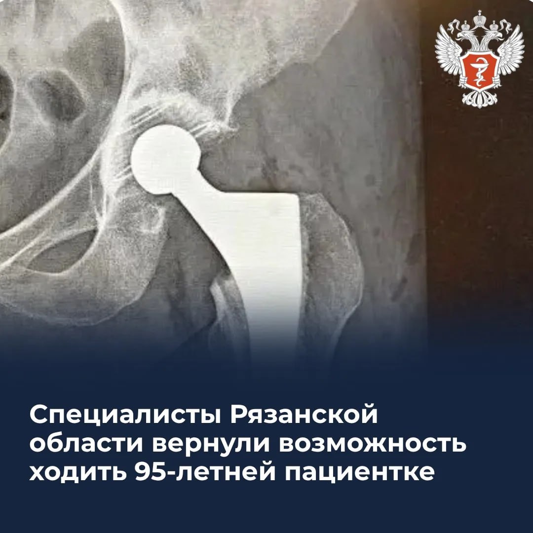 Специалисты Рязанской области вернули возможность ходить 95-летней пациентке